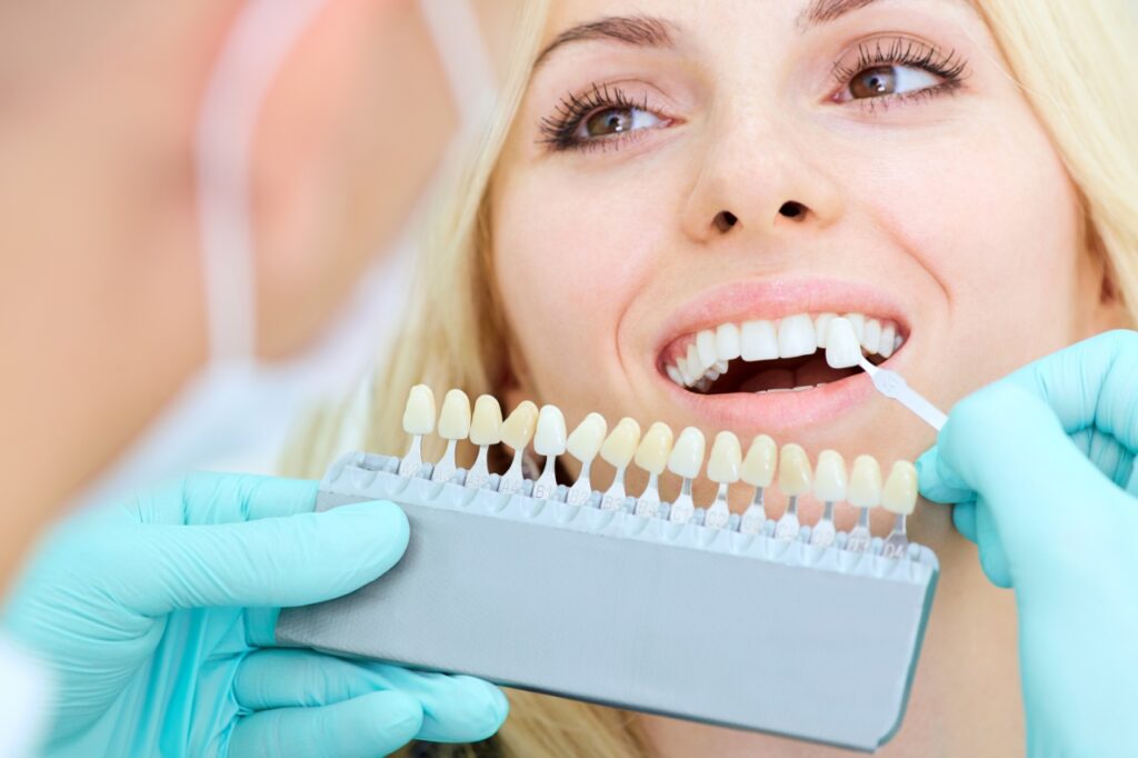 Teeth Whitening2